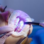 Gum Disease and Nutrition: What to Eat for Healthy Gums